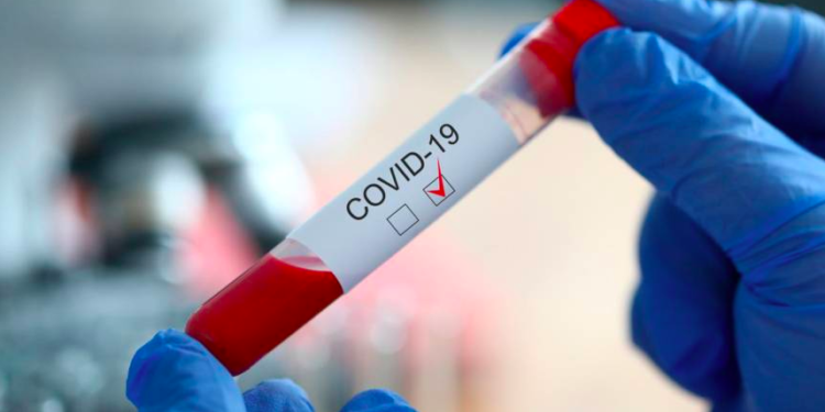 Le laboratoire du Département en capacité d’analyser 5 000 tests par semaine