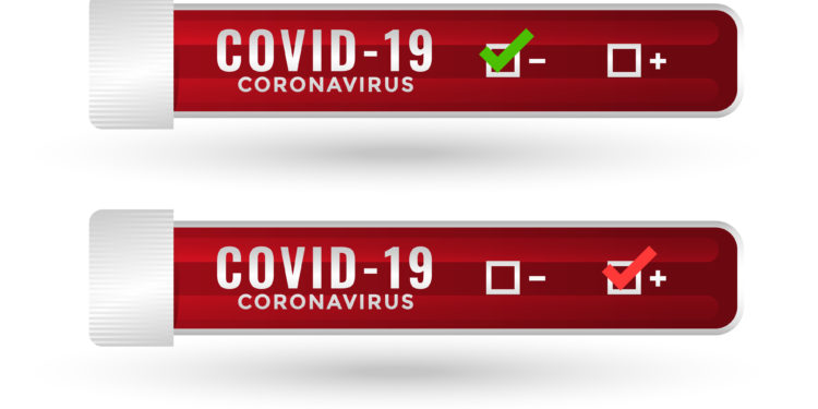 Covid-19 : les 120 tests du collège Paul Gauthier Cavaillon sont négatifs