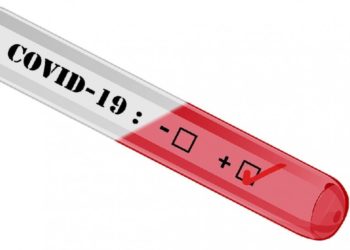 Covid-19 : où faire un test de dépistage rapide près de chez soi ?
