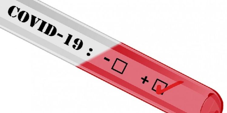 Covid-19 : où faire un test de dépistage rapide près de chez soi ?