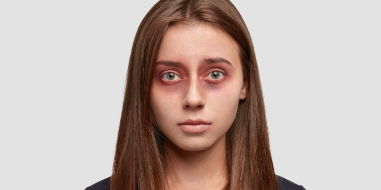 Violences conjugales : 22 places d’hébergement supplémentaires en Vaucluse