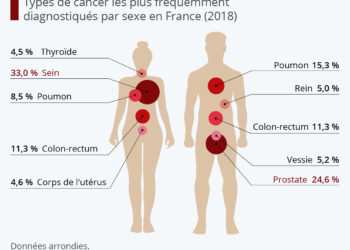 Les cancers les plus fréquents en France