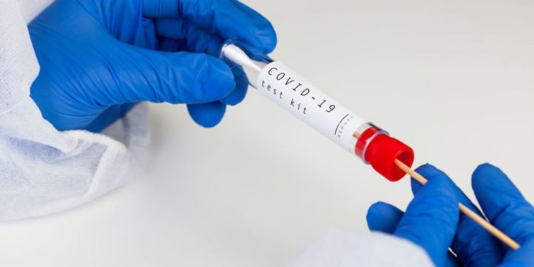 Covid-19 : une campagne de dépistage pour les étudiants et le personnel d’Avignon Université