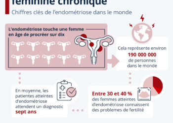 L’endométriose, maladie féminine chronique