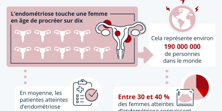 L’endométriose, maladie féminine chronique